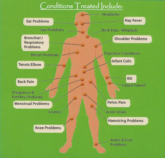 Bowen Technique conditions